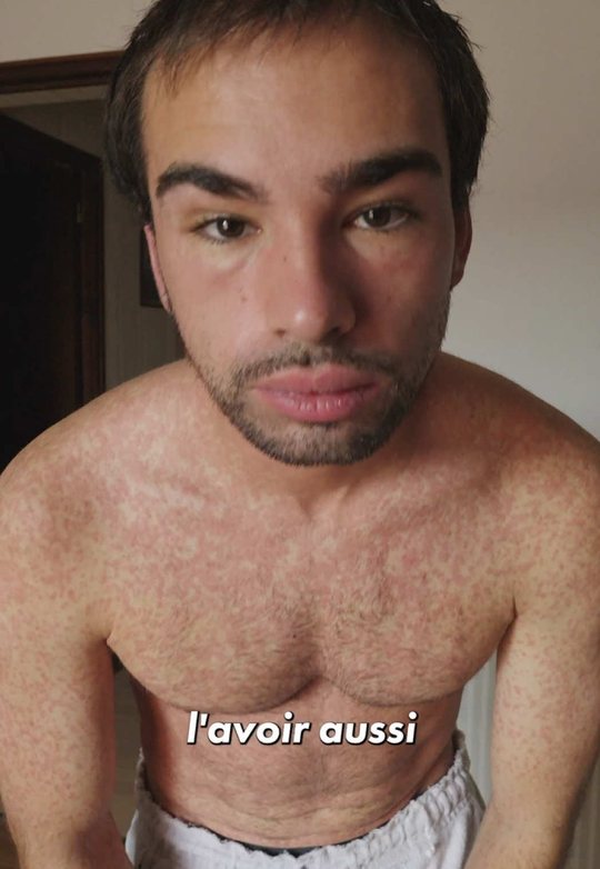 Mon mois de juillet et ma mononucléose